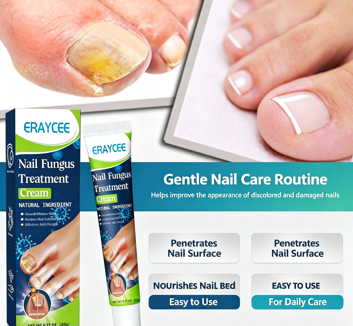 🔥ERAYCEE Herbal Anti-Fungal Nail Cream, Soft Nail Mask, Hand and Foot Repair Cream, Foot Care Antibacterial Cream