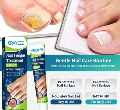 🔥ERAYCEE Herbal Anti-Fungal Nail Cream, Soft Nail Mask, Hand and Foot Repair Cream, Foot Care Antibacterial Cream